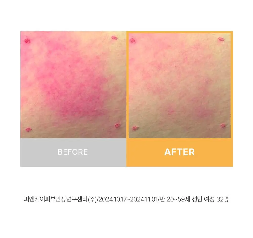 [다이아 광채] 아렌시아 라이스 뮤신 글로우 세럼 30ml 상세페이지 9